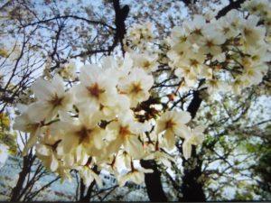 スタートの春!!針脱毛（ニードル脱毛）はじめました!!!