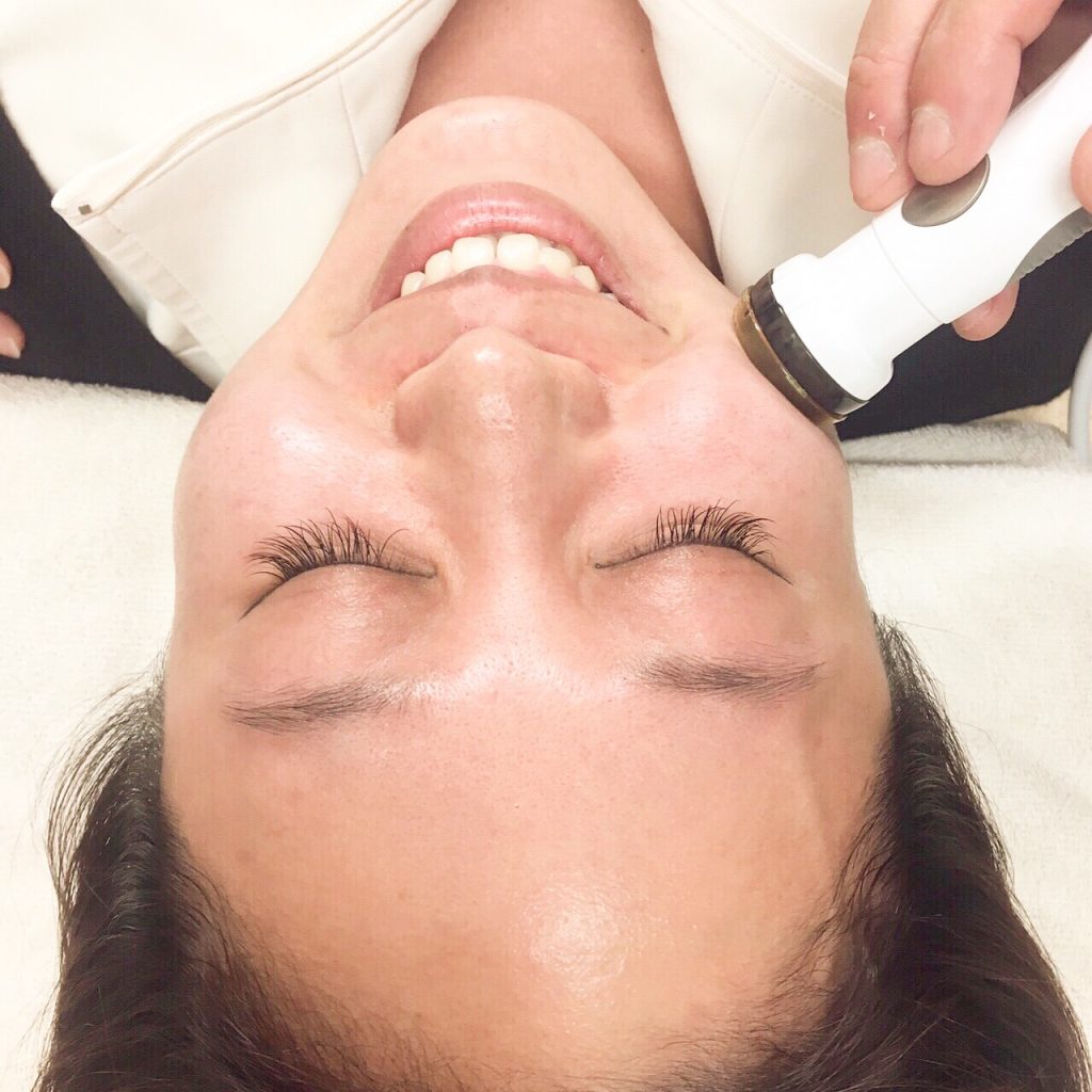 プラズマシャワーって？？