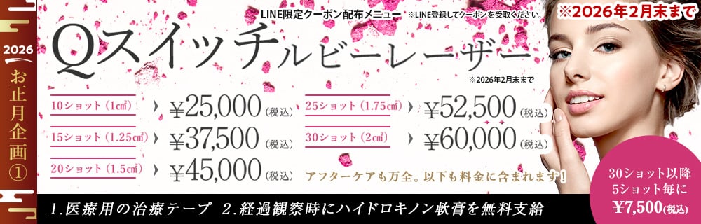 お年玉企画⓵　Qスイッチルビーレーザー