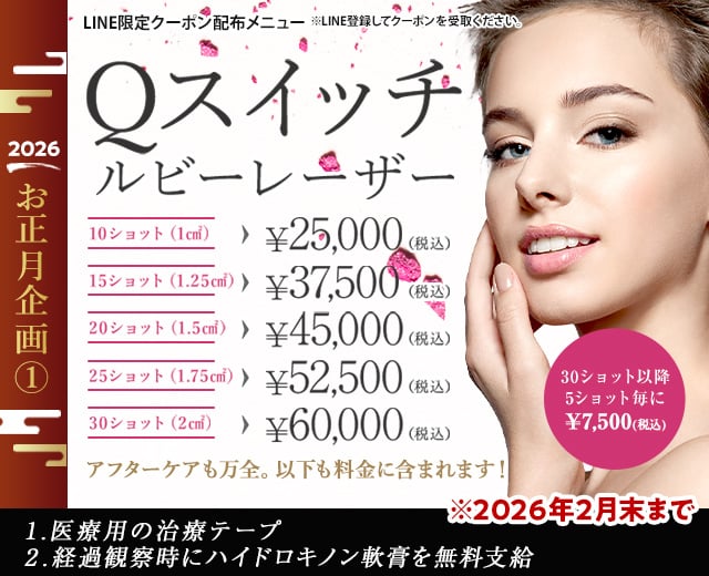 お年玉企画⓵　Qスイッチルビーレーザー