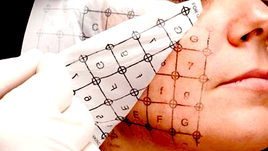 マーキング・グリッド